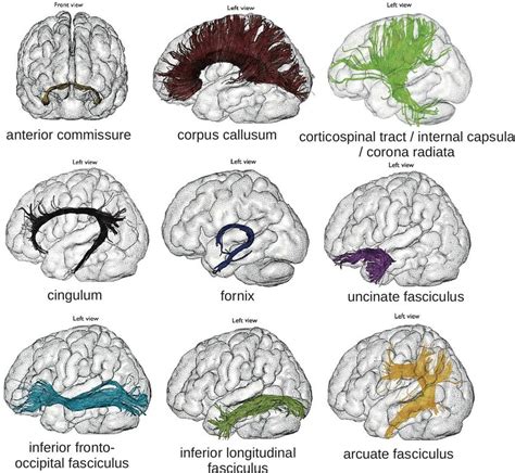 Oren Gottfried MD On Twitter The Main White Matter Tracts Of The