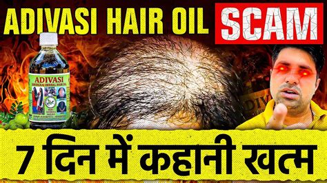 Scam Adivasi Hair Oil 😱 पूरी सच्चाई 7 दिन में कहानी खत्म Ayush