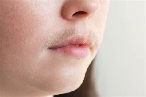 Advantages Of Laser Hair Removal For Facial Hair