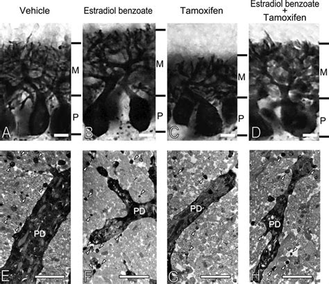 Ad Morphological Analysis Of Purkinje Cell Dendrites Of Newborn Wt