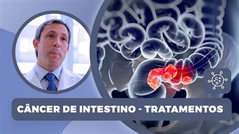 Câncer De Intestino Tratamentos Youtube