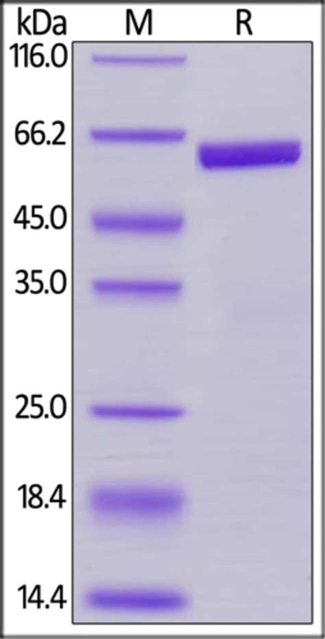 ACROBiosystems ACROBiosystems Biotinylated Human Prolactin PRL