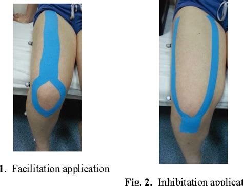 Effects Of The Direction Of Kinesio Taping On Sensation And