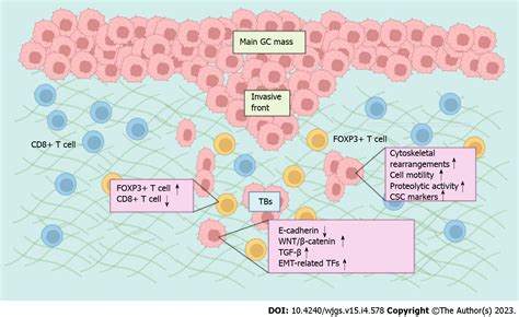 Tumor Budding In Gastric Cancer