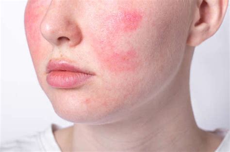 Sensitive Skin Causes Care And When To Seek Help