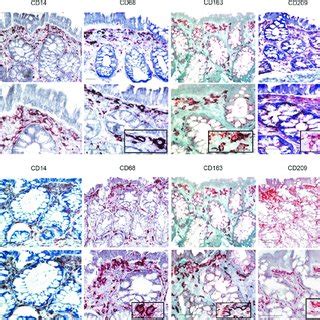 Morphology and distribution of monocyte/macrophage cell markers in ...