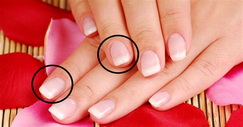 Your Fingernails Reveal Your Internal Health