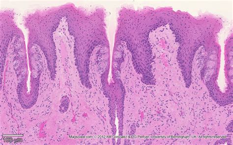 Tongue Histology Slide Labeled