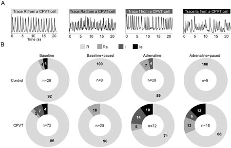 Intracellular Ca Cycling And Analysis Of Rhythm A Representative