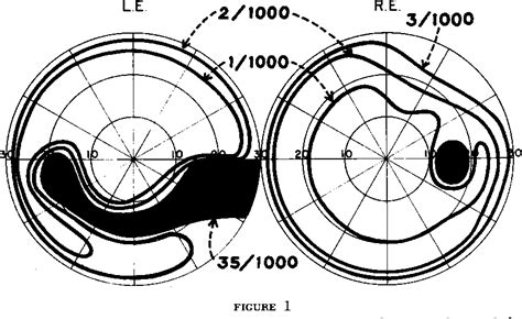 Figure 1 from THE BJERRUM SCOTOMA. | Semantic Scholar