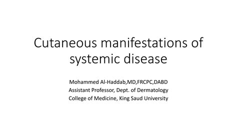 Ppt Cutaneous Manifestations Of Systemic Disease Powerpoint