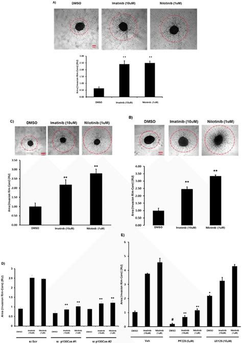 Imatinib And Nilotinib Treatment Of Human GBM Cells Leads To Increased