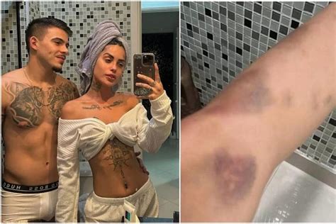 Tati Zaqui Desabafa Sobre Agressões De Thomaz Costa