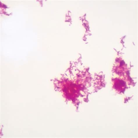 Acid Fast Stain, w.m. Microscope Slide | Carolina Biological Supply