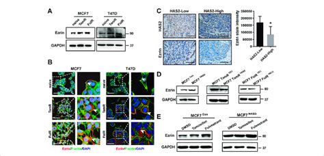 Has Decrease Upregulated Ezrin Expression In Response To Antiestrogens