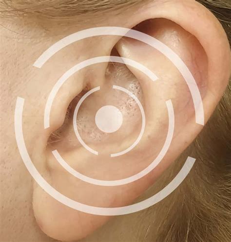 Common Ear Disorders