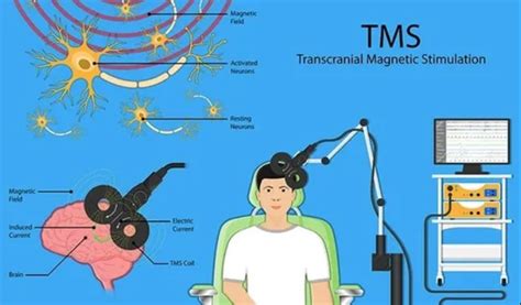 Mental Health Therapy What Can Be Treated With Tms