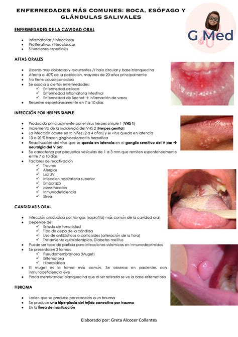 Enfermedades MAS Comunes ENFERMEDADES DE LA CAVIDAD ORAL