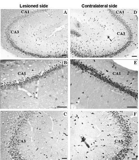 A representative photomicrograph of NeuN expression in the hippocampus ... 