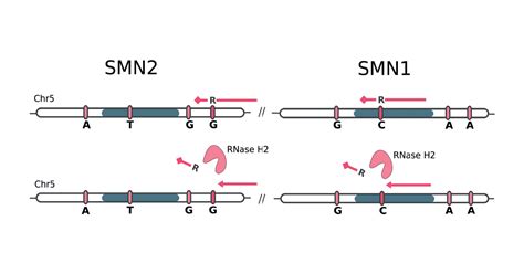 SMN1/SMN2 and spinal muscular atrophy case report - Blueprint Genetics