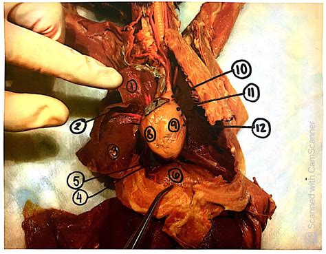 Cva Cat Cardio Diagram Quizlet