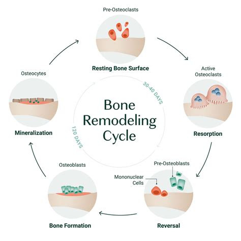 Is Osteoporosis Genetic AlgaeCal