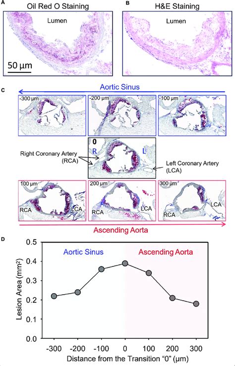 Cross Sections Of Mouse Aortic Roots Comparisons Between Oil Red O