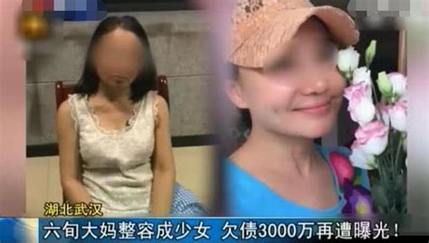 6旬大媽整容成妙齡少女，賣店借錢一年花400萬，還欠債三千萬 每日頭條