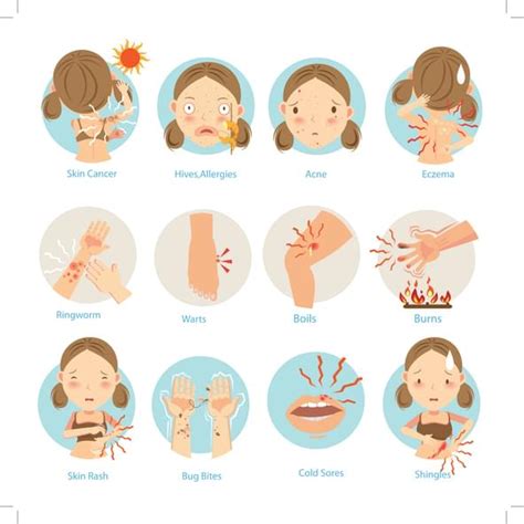 Psoriasis Rash Pictures Symptoms