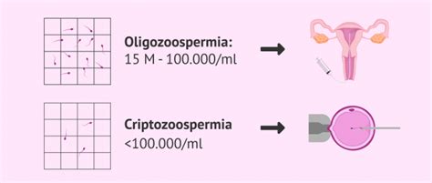 ¿cómo Se Analiza La Cantidad De Espermatozoides En El Semen