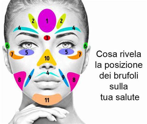 Brufoli sul viso Scopri ciò che significano con la face mapping