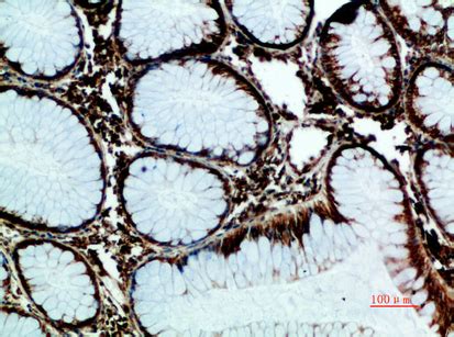 GRP78 BiP Polyclonal Antibody WB IHC P Buy Now Abcepta