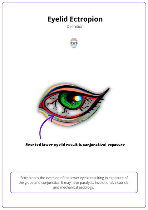 Ectropion · Causes, Assessment, Treatment.