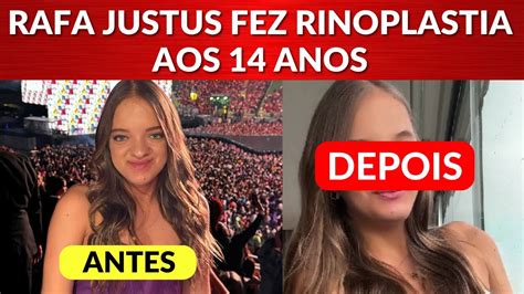 Rafa Justus Faz Cirurgia Est Tica Aos Anos Veja Antes E Depois