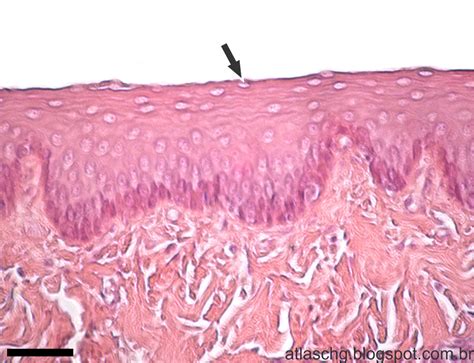 Epitelio Estratificado Pavimentoso Nao Queratinizado