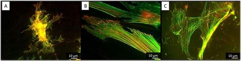 Visualization Of Actin Cytoskeleton Green And Focal Adhesions Viewed