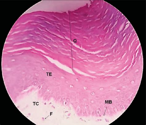 Epitélio estratificado pavimentoso queratinizado pele grossa CE