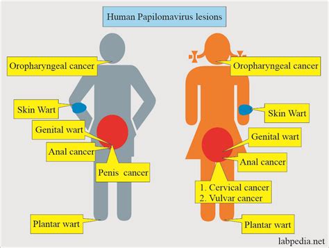 Hpv In Women Symptoms Pictures