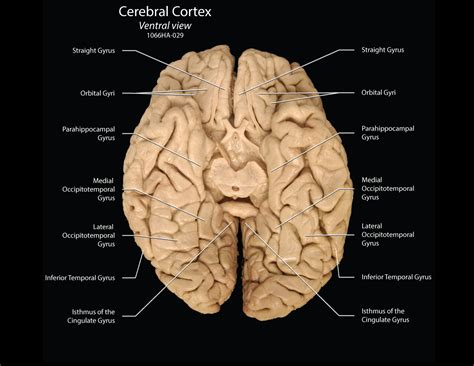 Lateral Surface Of Cerebral Cortex Gyri