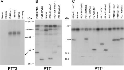 Mutation Analysis Of The Entire Pkd1 Gene Genetic And Diagnostic