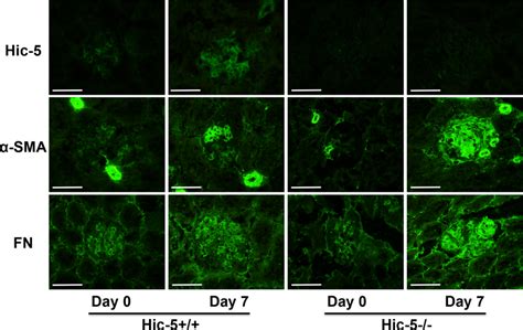 Glomerular Expression Of Hic Smooth Muscle Actin Sma And