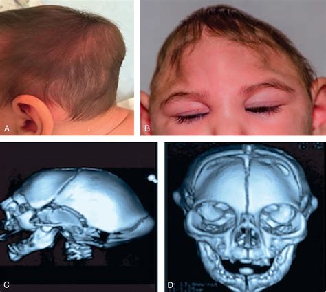 Fetal Disruption Clinical Tree