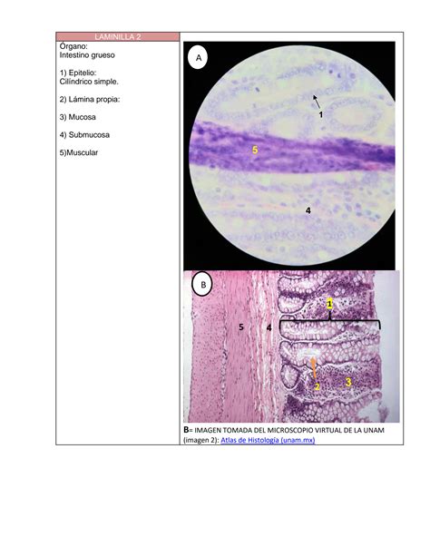 Solution Pr Ctica De Identificacion De Laminillas Histolog A Studypool