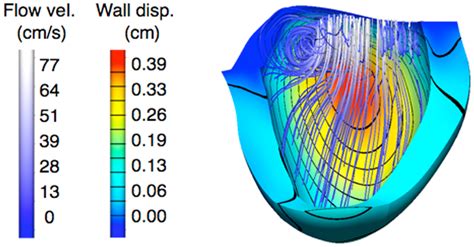 Example Of Results From Fluid Structure Interaction Fsi Simulations