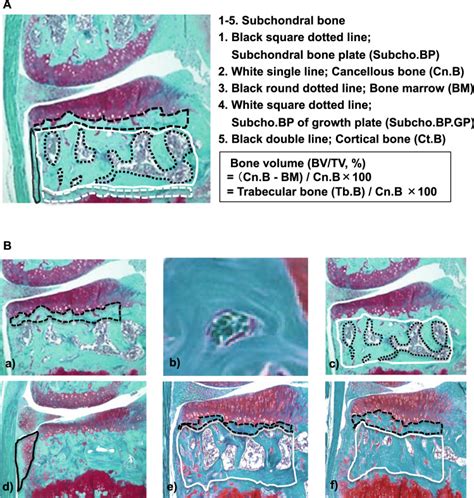 Histological Scoring System For Subchondral Bone Changes In Murine