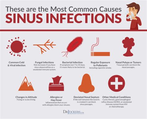 Sinus Infections Causes Symptoms And Natural Support Strategies