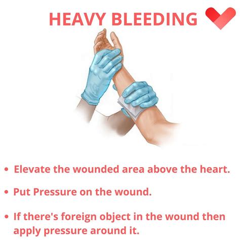 First Aid For Severe Bleeding