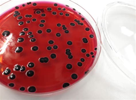 8 Hilarious Salmonella enterica Puns - Punstoppable 🛑