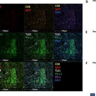 Act Of Ny Eso Transgenic T Cells And Given With Dc Vaccination And