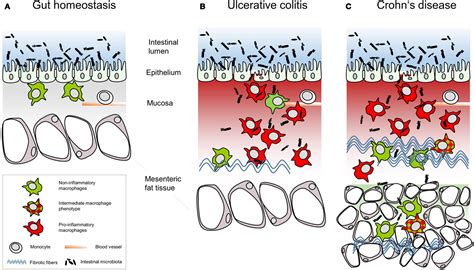 Frontiers Diversity Of Intestinal Macrophages In Inflammatory Bowel Diseases